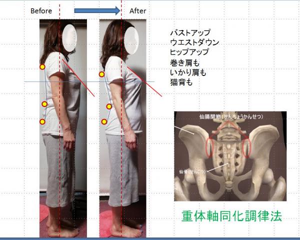 仙腸関節＆骨盤底筋リリース 「重体軸SKB法」